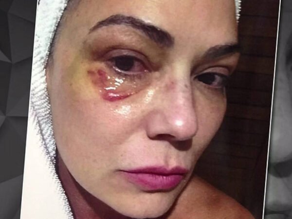 Luiza Brunet comenta indenização de R$ 150 mil paga por ex