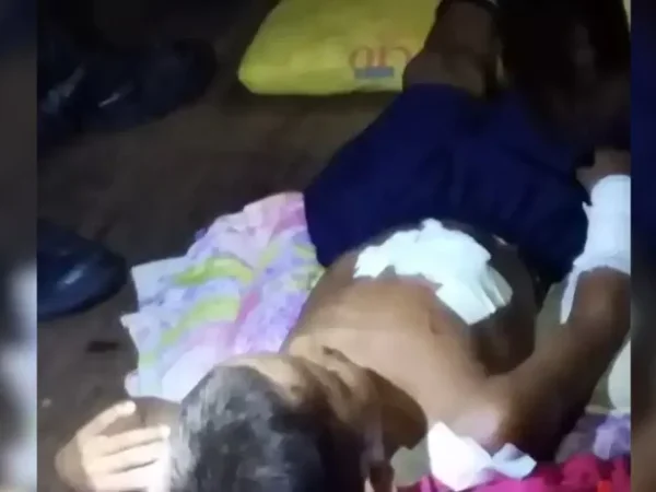 Criança sofre ataque de jacaré em comunidade ribeirinha de Fonte Boa
