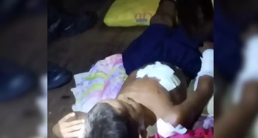 Criança sofre ataque de jacaré em comunidade ribeirinha de Fonte Boa